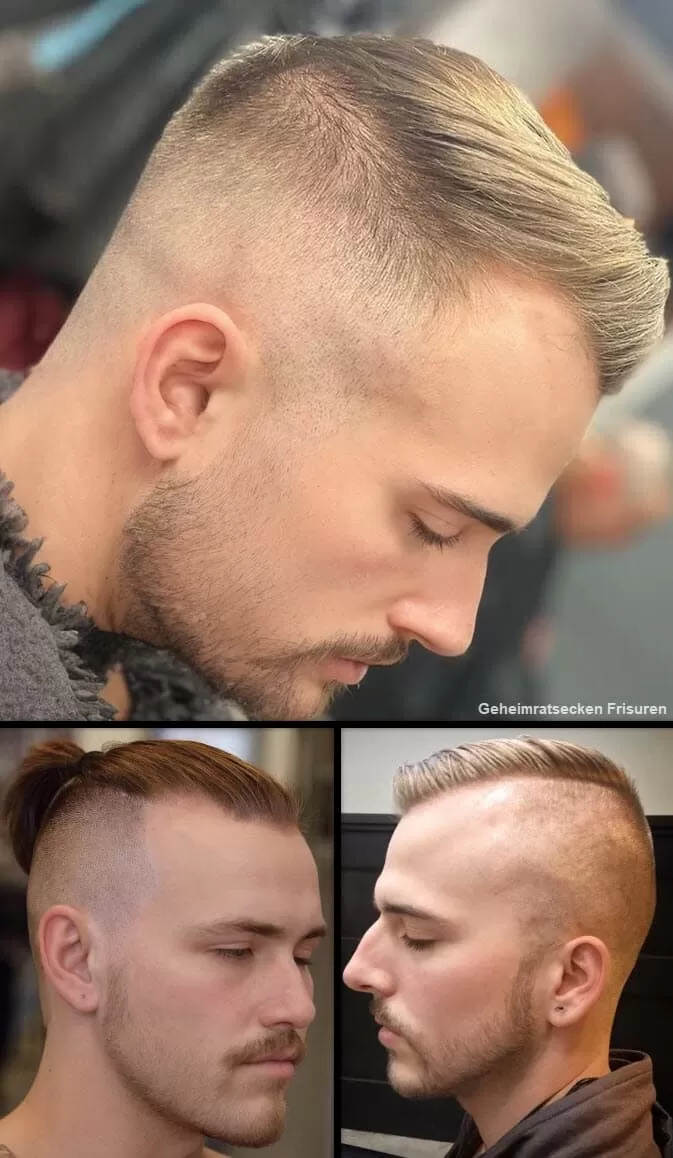 Geheimratsecken Frisuren (Tarnen Sie Kahlheit Geschickt!) Herren Frisuren 