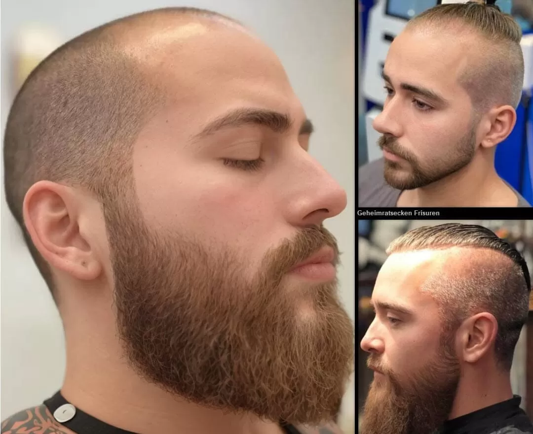 Geheimratsecken Frisuren (Tarnen Sie Kahlheit Geschickt!) Herren Frisuren 